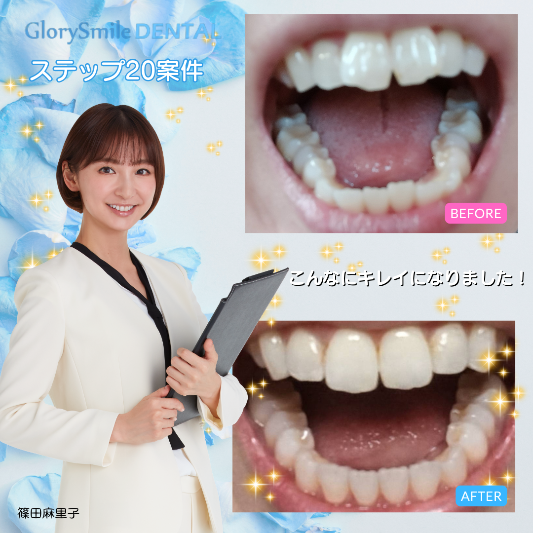 BeforeAfter 1