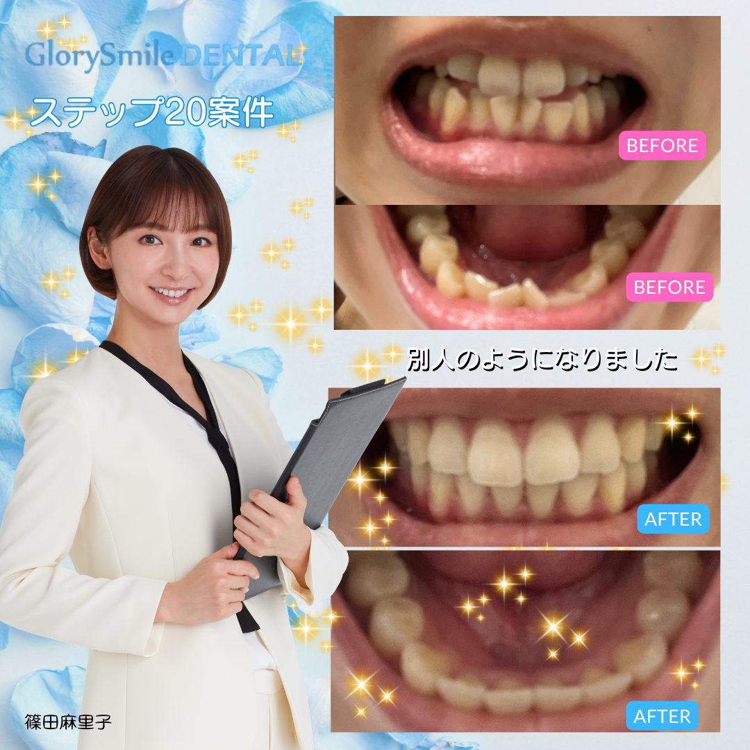BeforeAfter 5